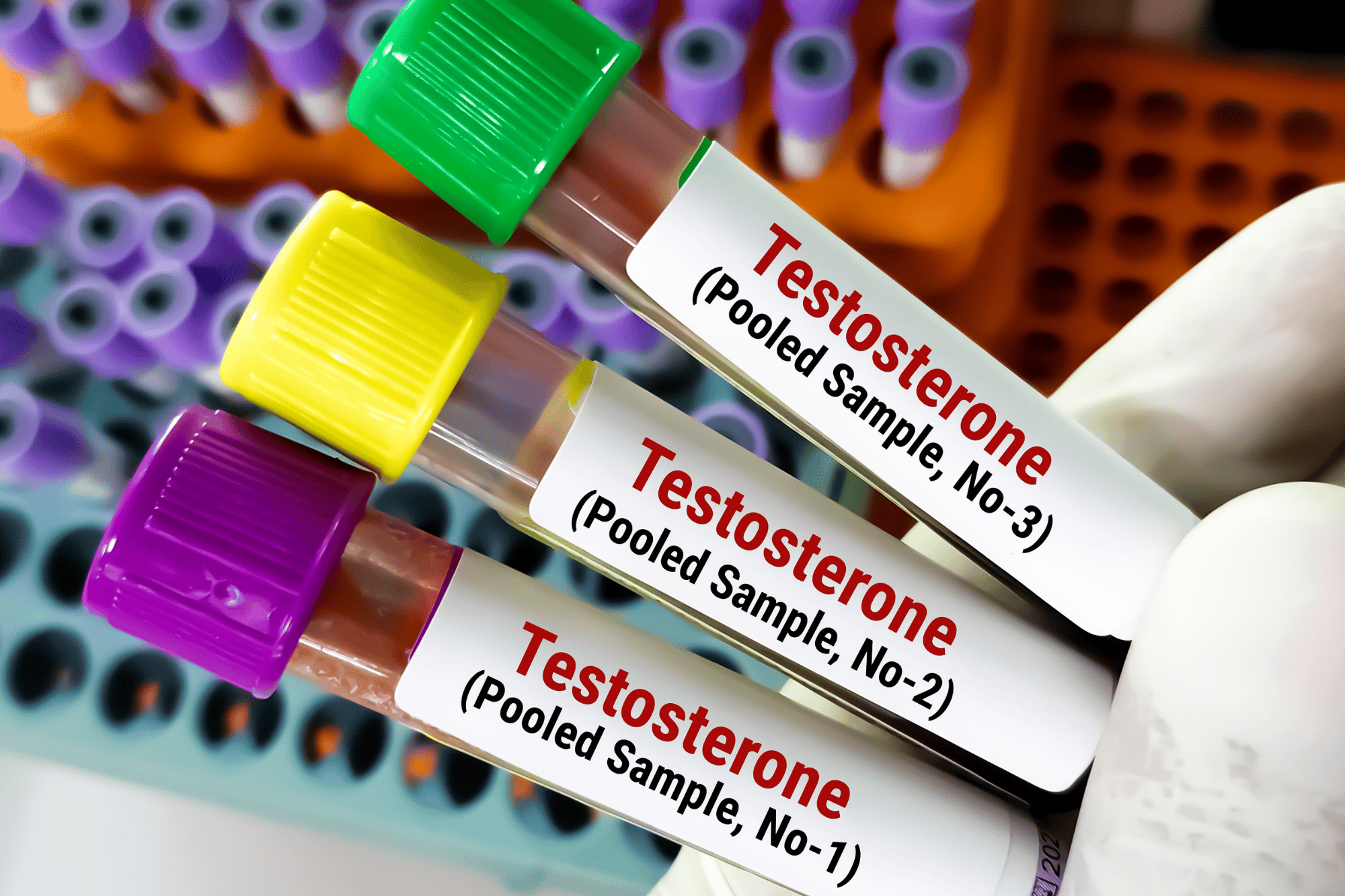Testosterone supplementation in Biorestore