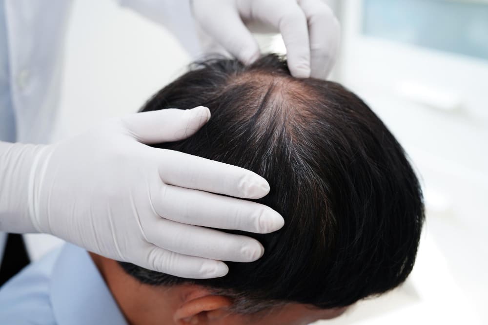 Dealing with thinning or balding hair